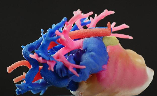 Órganos de juguete para practicar cirugías complejas